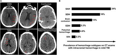 Computational Approaches for Acute Traumatic Brain Injury Image Recognition